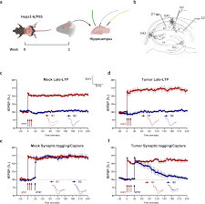 Tumor-mediated microbiota alteration impairs synaptic tagging/capture in  the hippocampal CA1 area via IL-1β production | Communications Biology