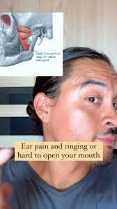 Quick release for ringing ear, glue ear, blocked eustachian tube and more  👂 💀 , The medial pterygoid muscle refers pain in poorly circumscribed  regions related to the mouth (tongue, pharynx, and hard ...