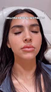 Crazy how the very first sin was a woman who ATE., 💋💋 💋💋 💋,  _______________________________________, SCHEDULE LIP FILLER TODAY, To book  —, www.belloramedicalaesthetics.com, Beth Myrick, ARNP, 📍 2722 ...