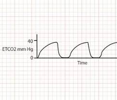 Copd inhalers chart uk kronis q. Athma Assessment Treatment 5 Tips Paramedics Need To Know