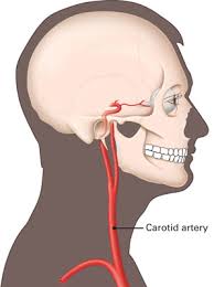 Image result for carotid artery