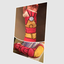 Iron Man Arm Cast Arm Cast It Cast Draw On Photos