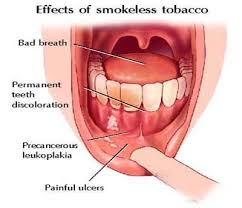 Pin On Smokeless Tobacco