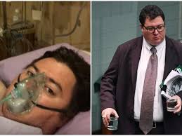 George robert christensen is an australian politician and former journalist who has been a member of the australian house of representatives. Mp George Christensen Reveals Radical Weight Loss Surgery After Reaching 176kg