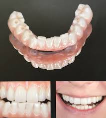 Nov 04, 2020 · the expenses will also depend upon the kind of bridge that you pick: Denture Implants Vs Fixed Bridge Teeth Replacement Options False Teeth