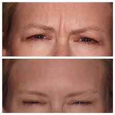 Osborn Advanced Dentistry Sleep & Breathing Wellness