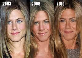 Pin On Celeb Surgery