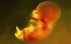 Image result for Free stock photos of abortions and euthanasia