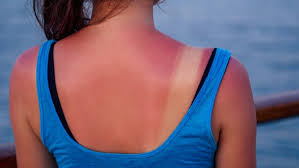 Tentu saja menghilangkan angka dibelakang koma yang dimaksud disini bukan hanya sekedar tampilannya saja, sedangkan valuenya tetap berupa rumus menghilangkan angka dibelakang koma. 8 Cara Cool Hilangkan Sunburn Di Muka