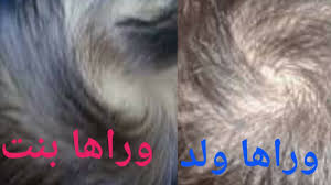 عملى معرفه نوع الجنين من بريمه الراس لفه الشعر للطفل الى قبله دون اللجوء للسونار مضمونه100 Youtube