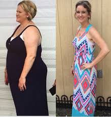 Image Result For Top 10 Tips Before And After Gastric Bypass Surgery Sleeve Surgery Gastric Sleeve Surgery Gastric Sleeve