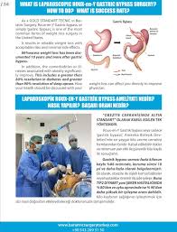 Arabic Obesity Bariatric Surgery
