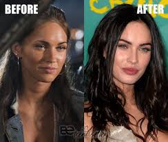 — 2000s (@popculture2000s) october 16, 2020. Megan Fox Plastic Surgery Before And After Revealed 2019