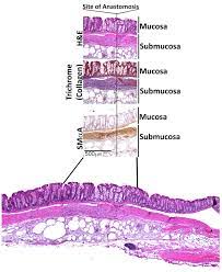 Mild to moderate diarrhea may occasionally persist for weeks to months after surgery, and some cats may have recurrent constipation. Creation Of Colonic Anastomosis In Mice Protocol