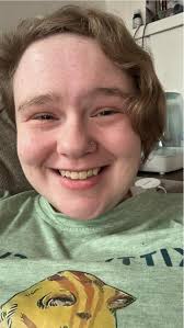 Happy FIF peeps! Sorry it's not the cutest picture but I just had surgery  yesterday and I am recovering 🖤 hope you ferals all have a wonderful  Friday! 🫶