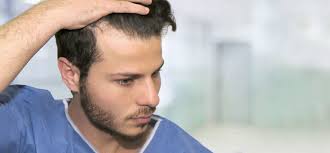 Thinning hair can be distressing to experience, especially when you don't know what's causing it. How Beat The Early Signs Of Hair Loss Blog Plus