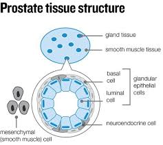 An increased psa level a biochemical relapse is when your psa level rises after having treatment that aims to cure your cancer. Rare Prostate Cancers Prostate Cancer Uk