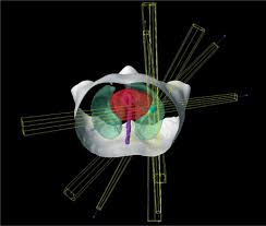 نتیجه جستجوی لغت [inoperable] در گوگل