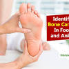 Bone cancer develops in the skeletal system and destroys tissue. 1