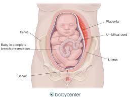 This age range is the sweet spot, since babies are old enough to physically make it for. Fetal Presentation Before Birth Babycenter