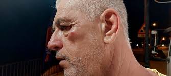 Sliema mayor John Pillow attacked after stopping people from urinating in  public