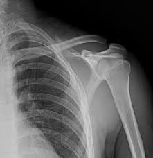 Image result for Fall on Shoulder