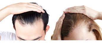 (dht) risulta essere utile sia per contrastare la perdita di capelli e la . Vitaminity Ajuga Reptans Extract 10 1 500mg