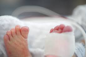 A long blonde hair wrapped around his toe. How To Get Rid Of Hair Tourniquets From Baby Toes Popsugar Family