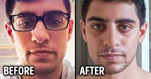 Care credit viewer questions answered about applying for this credit card and also tips to use when applying! Why We Need To Stop Shaming People Who Get Cosmetic Surgery