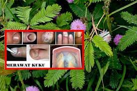 Cari tahu dengan mengintip daftar khasiat tanaman ajaib ini. Petua Berkesan Rawat Kuku Bermasalah Inilah Manfaat Daun Semalu Mimosa Pudica Yang Ramai Tidak Tahu Kartel Dakwah
