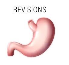 Pin On Revision Back On Track