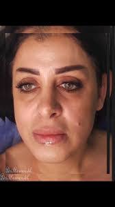 Rawan Alkhateeb's Instagram, Twitter & Facebook