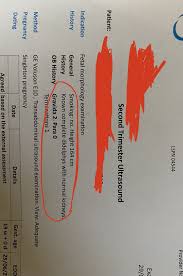 Keep in mind, your teacher won't be able to distinguish single or double spacing. Hi My Name Is Evelyn I Was Born With Two Vaginas 2 Completely Independent Reproductive Systems I Was A High Class Independent Escort For 8 Years And Used One Vagina For Work