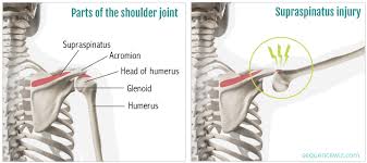 Pin On Joga Articles