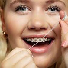 JORDAN CLINIC Brace Floss is the dental floss for braces, implants and  bridges. The stiffened-end sections at the end of each strand, help  threading the floss between teeth and under braces, bridges