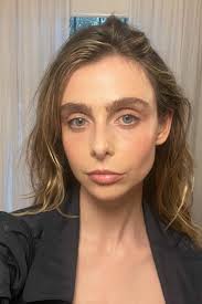 Is microneedling the best alternative to filler and botox? The Skin Bar's Samantha  Appel says yes