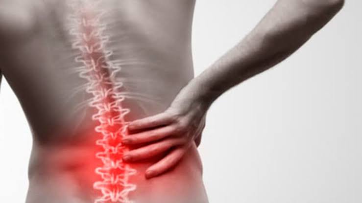 Espondilolistese - Escorregamento vertebral - Dr. Alberto Gotfryd