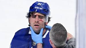 On thursday morning, leafs pr's twitter account informed fans that centre john tavares sustained an oblique injury while training. Mnvhmoahrcz3dm