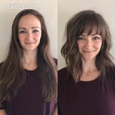 Also, an asymmetrical crop with a deep side part can work wonders to disguise thinning hair. The Best Treatment For Receding Hairline Hair Loss How To Stop