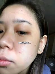 If your tumm is looking like this Join our April class that is starting  tomorrow so can get rid of the bell fat And get back to better shape Click 