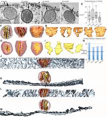 Maybe you would like to learn more about one of these? Altered Outer Hair Cell Mitochondrial And Subsurface Cisternae Connectomics Are Candidate Mechanisms For Hearing Loss In Mice Journal Of Neuroscience
