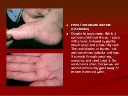 Shoe contact dermatitis is generally an itchy and peeling rash on the balls of the feet, bottom of the toes, or heels. Rashes When To Worry