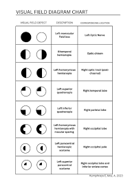 Image result for Visual Field Deficit
