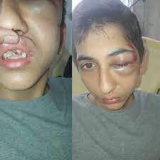 Gabriel, 14 ans, a cru qu'il allait « mourir en garde à vue » - Bondy Blog