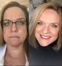 When Clelia Lavoie began experiencing abdominal pain in 2019, her instincts  told her something wasn't right, even though her primary care doctor  dismissed her symptoms. She turned to Dana-Farber