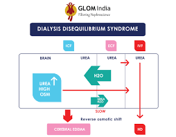 Case Report Of New Onset Seizures During Dialysis An Approach For Dialysis Disequilibrium Syndrome By Dr Vipul Gattani Dr Siddhi Sane Glom India