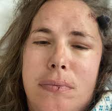 Mum's brain surgery brings 'miracle' relief