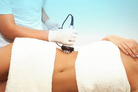 Laser Lipolysis