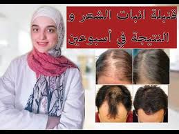 قنبلة انبات الشعر علاج الصلع وملئ فراغات فروة الراس بمكون طبيعى مينوكسيديل طبيعى بدون اثار جانبية youtube in 2021 hair ali quotes fashion