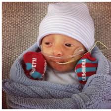 Baby Born With Trisomy 18 — Daniel and Abel Crawford